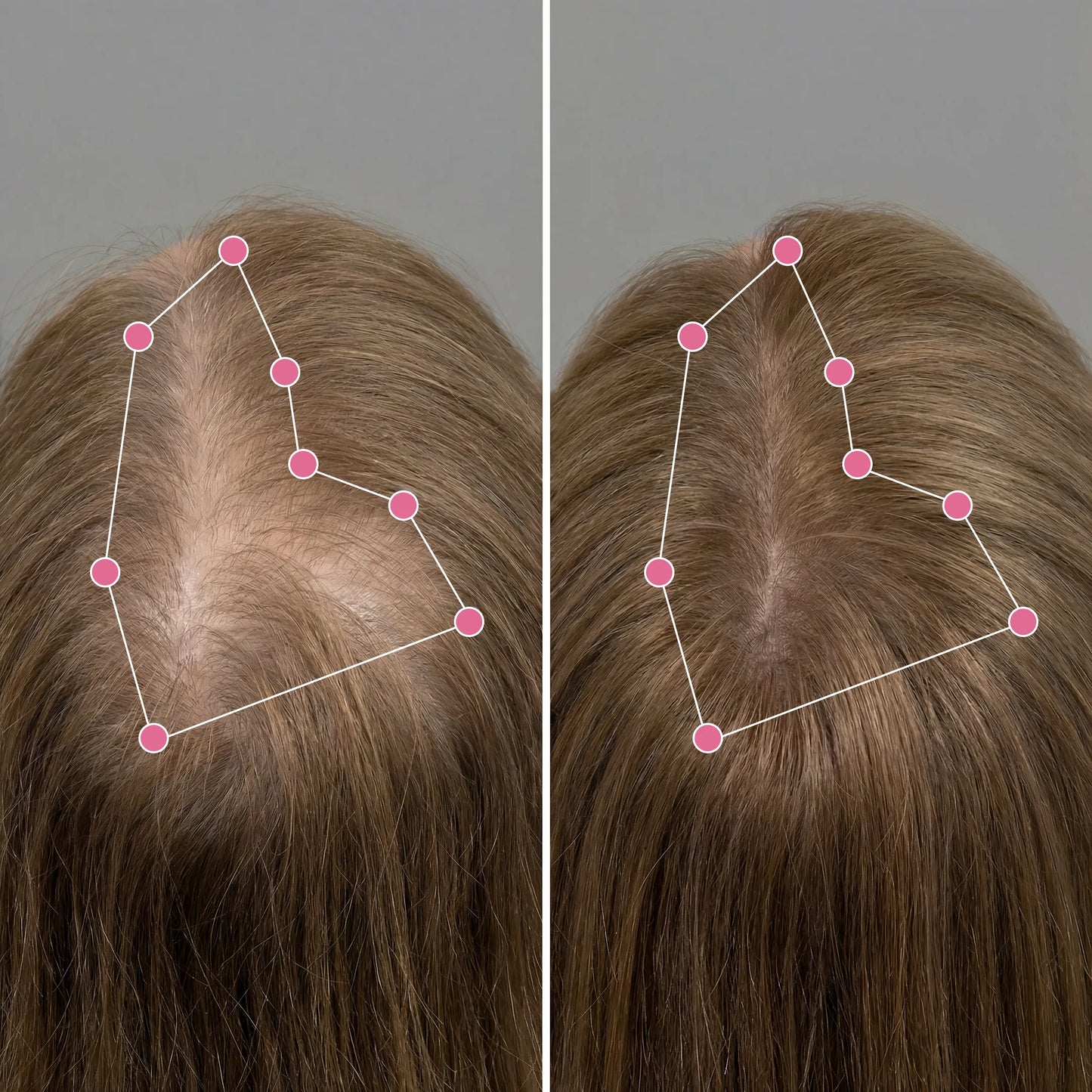 Korean Scalp Revival Bar Vid